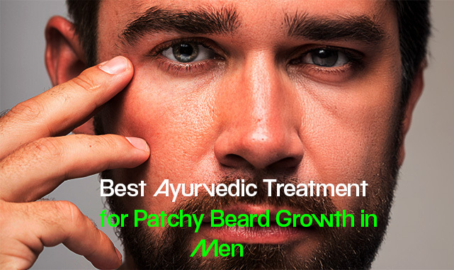 Best Ayurvedic Treatment for Patchy Beard Growth in Men
