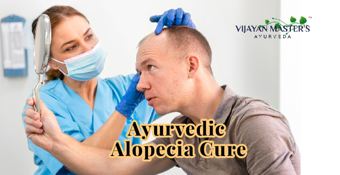 Can Ayurveda cure Alopecia Areata?