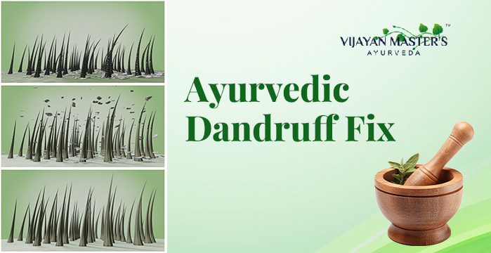 Flake-Free with Ayurveda: Your Definitive Dandruff Solution