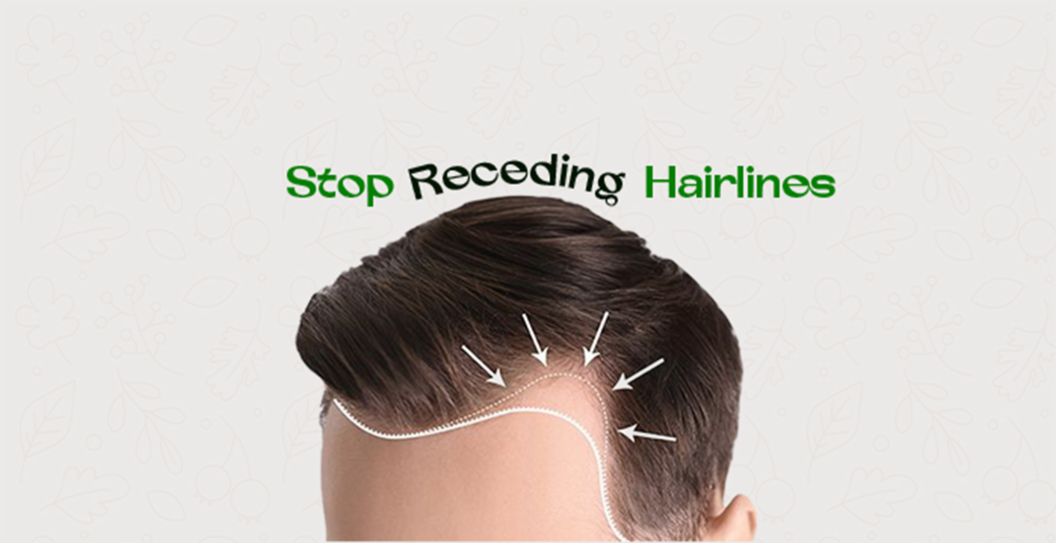 Combating Receding Hairlines: Strategies for Halting Hair Loss