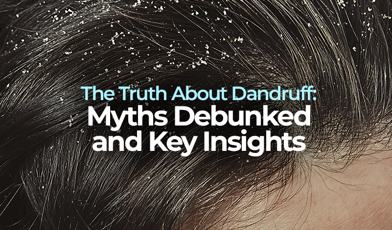 The Truth About Dandruff: Myths Debunked and Key Insights